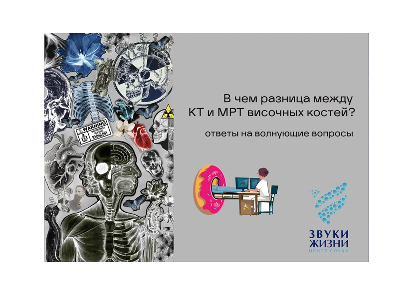 В чем разница между КТ и МРТ височных костей? Ответы на волнующие вопросы.